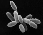 Imagem B: aglomerado de células Halobacterium sp. cepa NRC-1. Os Archaea são um grupo de microorganismos unicelulares. Foto: NASA.