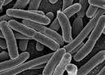 Imagem C: microscopia eletrônica de varredura em uma bactéria Escherichia coli bacilli. Imagem: NIH.